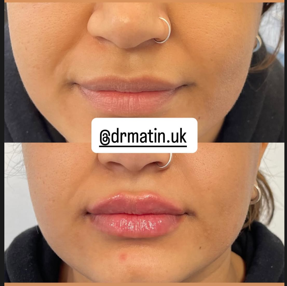 Clinic-supplied comparison of a patient’s lips